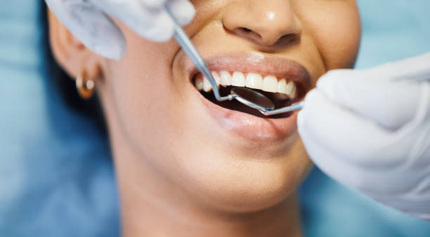 Best Urgent Care for Lost Fillings or Crowns in Monte Alto, TX